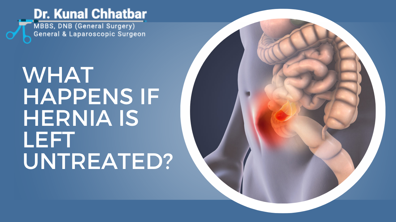 Untreated Hernia Risks