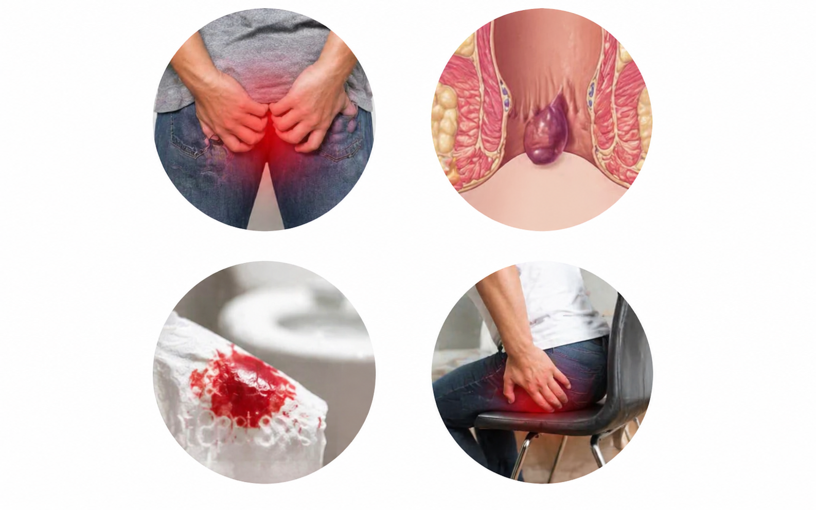 Symptoms of Piles